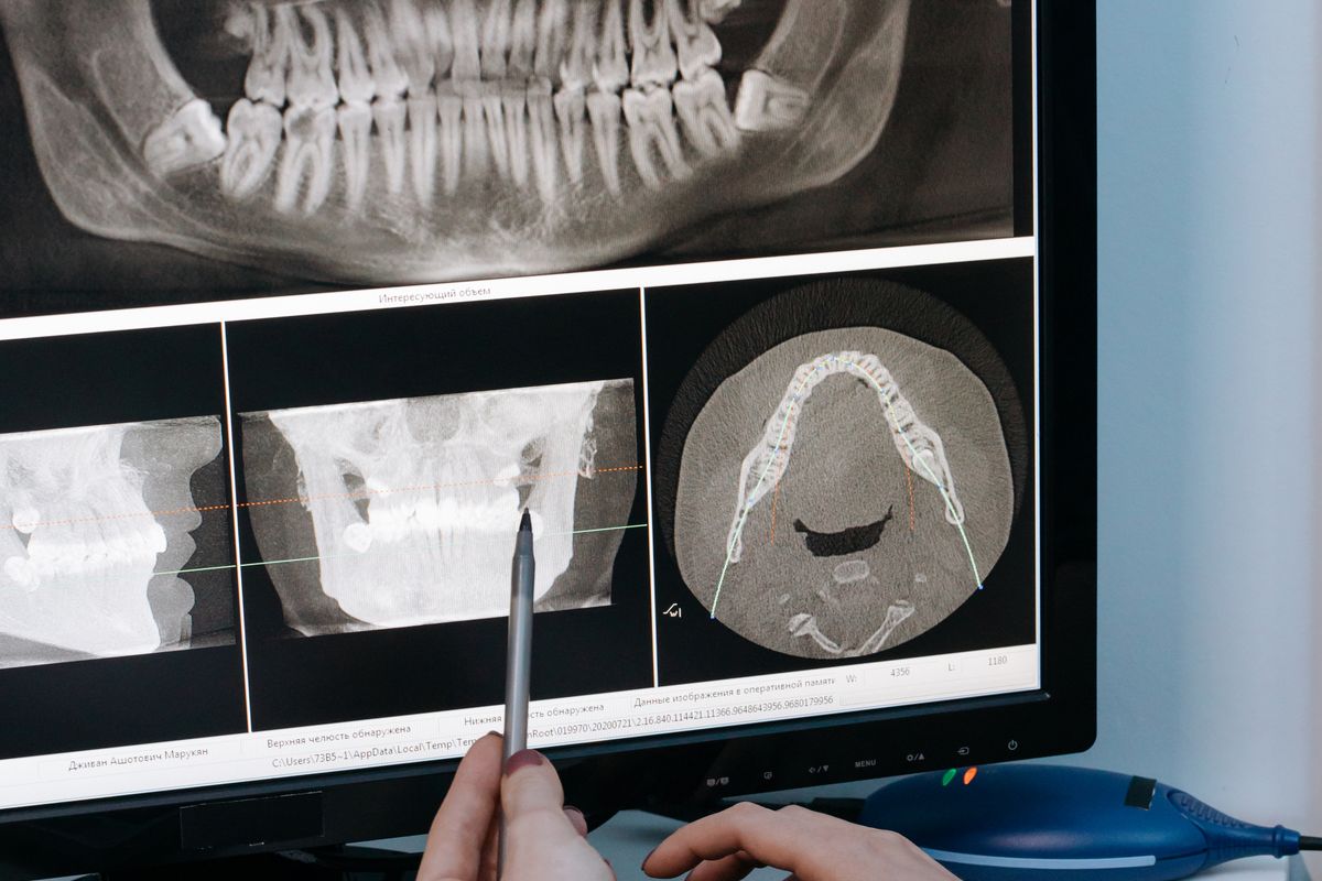 Dentista analizando una radiografía dental digital en la pantalla para el diagnóstico