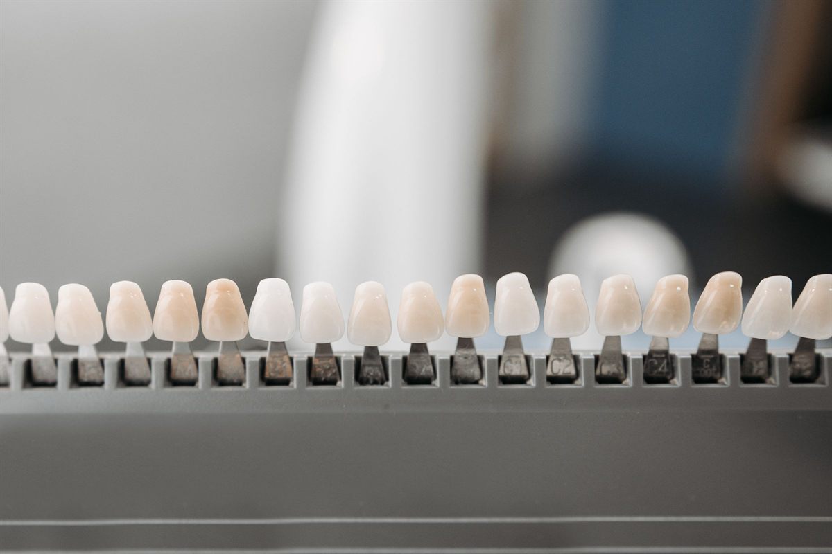 Mock-up digital de carillas dentales mostrado en una tablet por el odontólogo