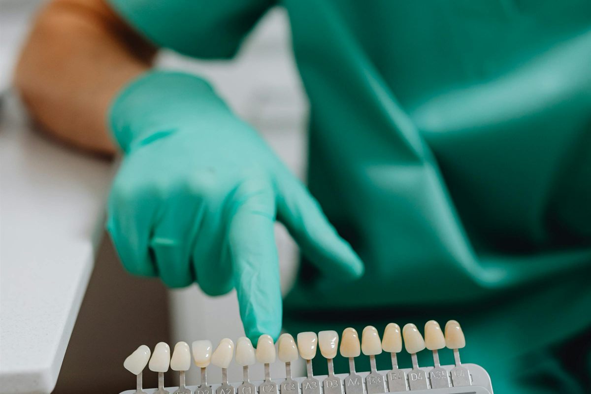 Carilla dental brillante simbolizando la duración y el mantenimiento en el tiempo
