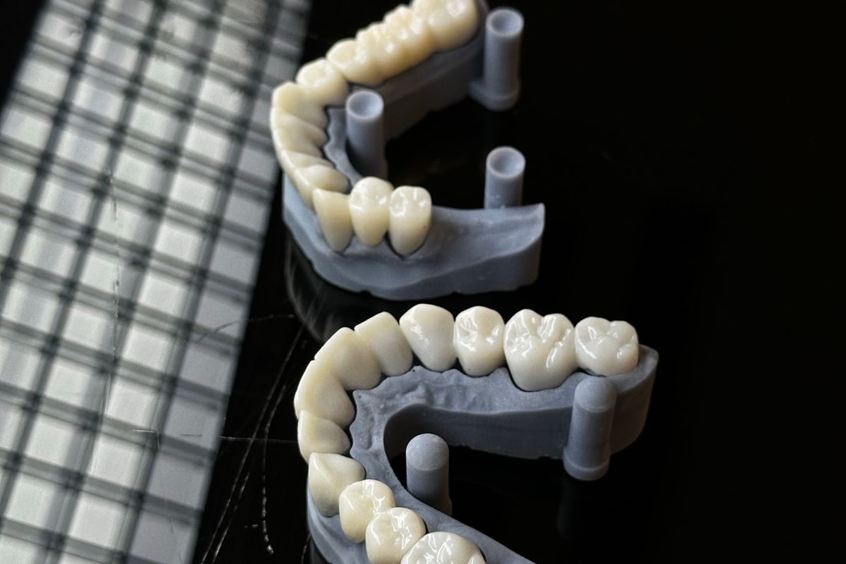 Fresadora CAD/CAM dental fabricando una pieza cerámica en la fase CAM del flujo digital