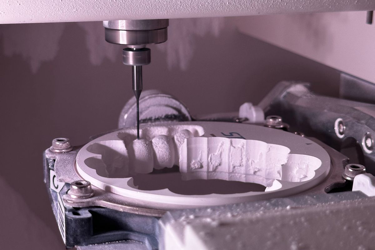 Fresadora CAD/CAM tallando una corona dental de cerámica en la fase CAM