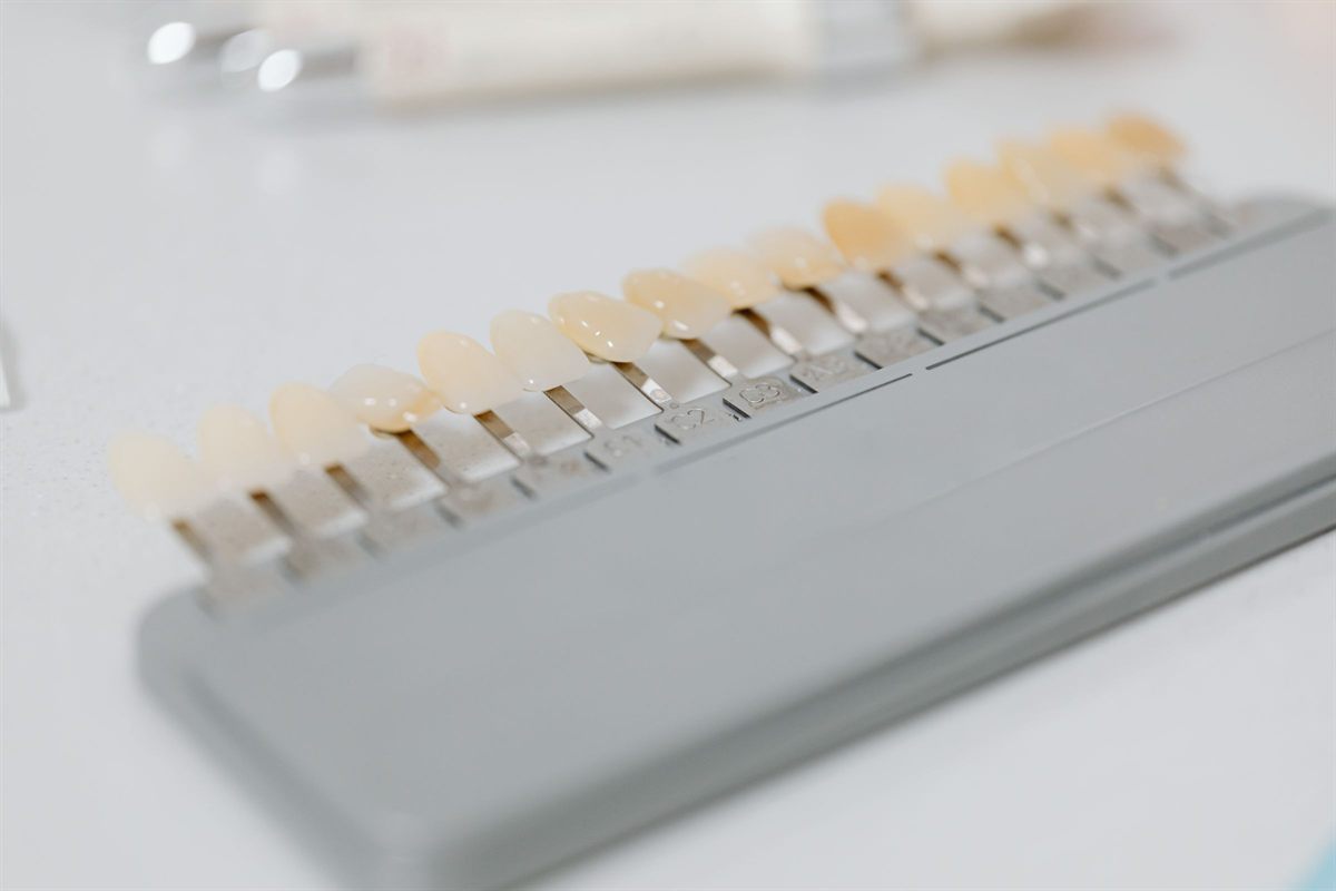 Jeringa profesional de gel blanqueador con peróxido de hidrógeno usado en blanqueamiento dental