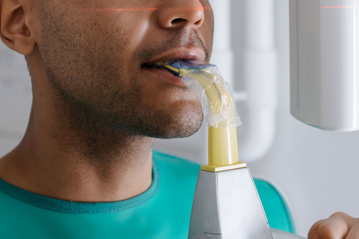 Equipo de radiografía dental digital de baja radiación en la clínica