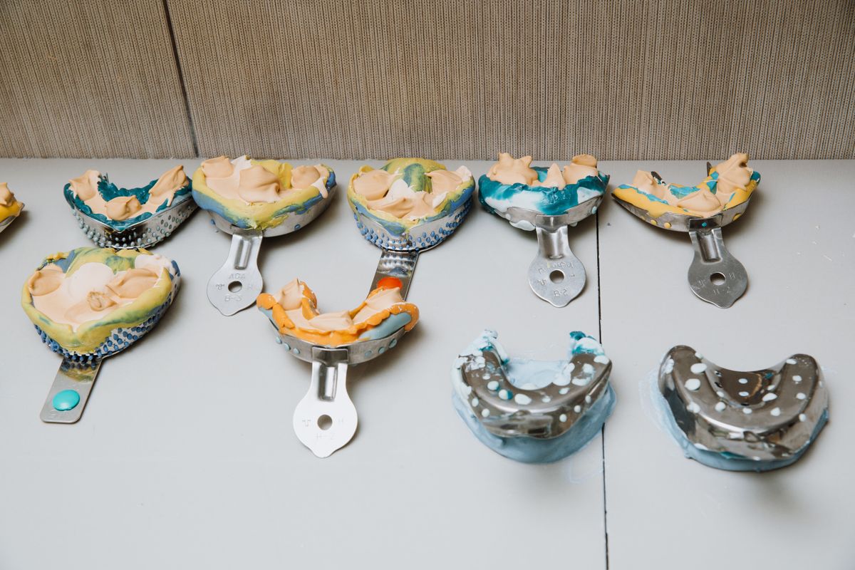Cubetas de impresión dental con pasta de alginato, el método tradicional de toma de medidas