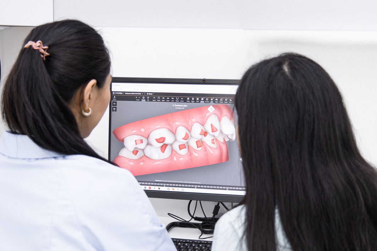 Modelo digital 3D de la arcada en pantalla, más preciso que el modelo de yeso tradicional
