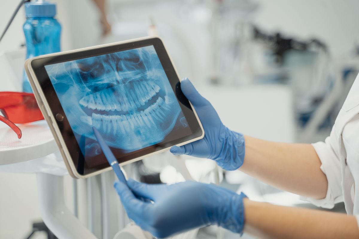 Radiografía panorámica dental digital mostrada en una pantalla para el diagnóstico