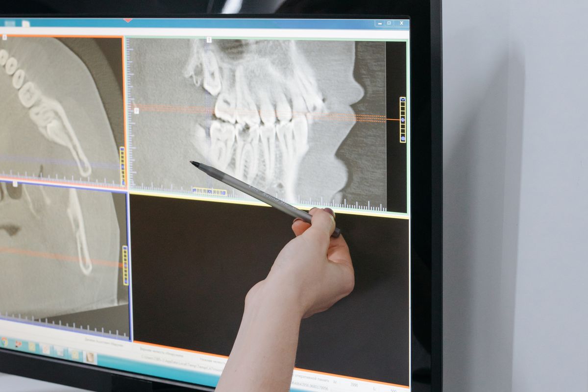 TAC dental CBCT con reconstrucción 3D de los maxilares para el diagnóstico digital