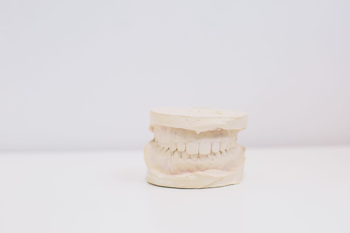 Moldes vs escaner 3d