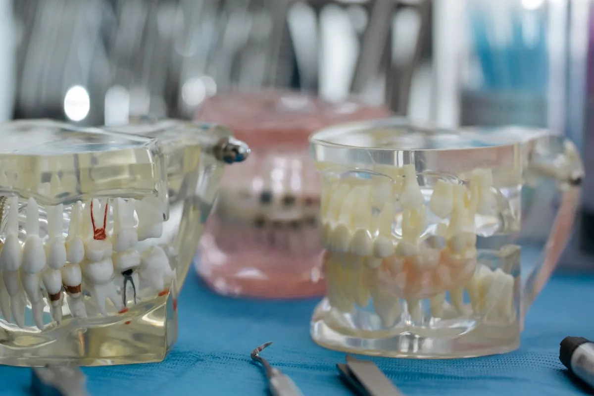 Modelo dental transparente con los conductos de la raíz marcados, como se tratan en una endodoncia