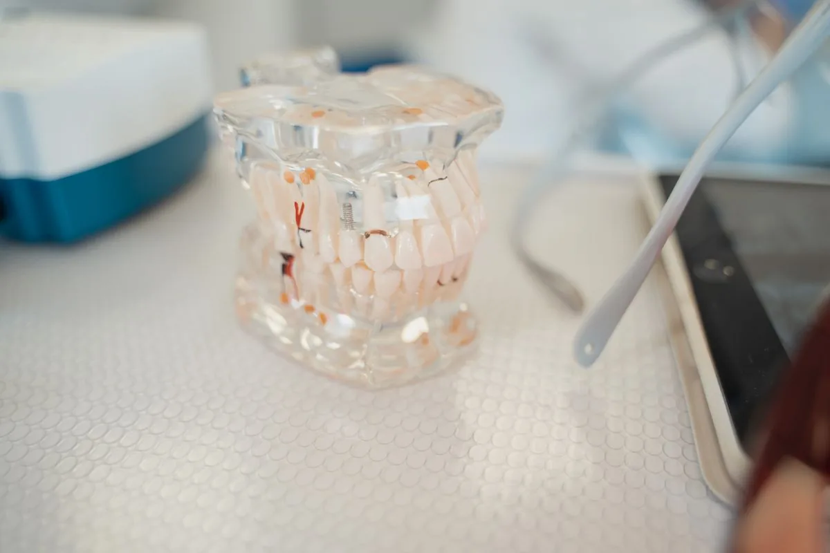 Modelo dental transparente con las raíces a la vista para explicar la bolsa periodontal y la pérdida de inserción