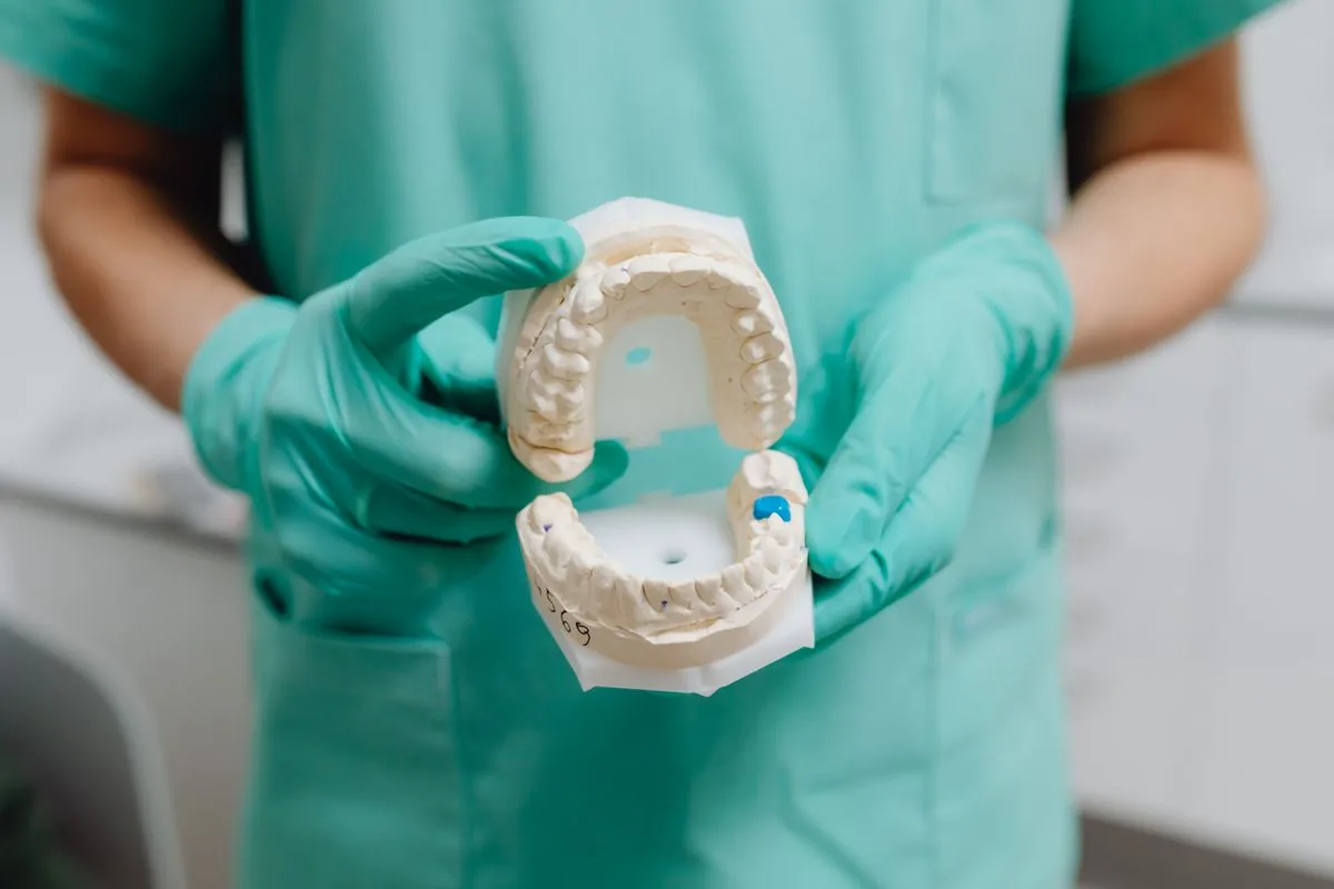 Modelo dental para explicar los tipos de recesión gingival RT1, RT2 y RT3 según la encía entre dientes