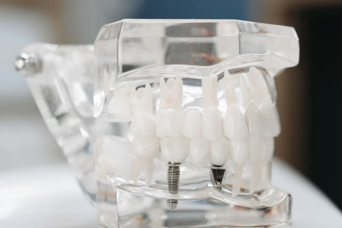 Modelo transparente de implantes dentales en el hueso para entender la mucositis y la periimplantitis