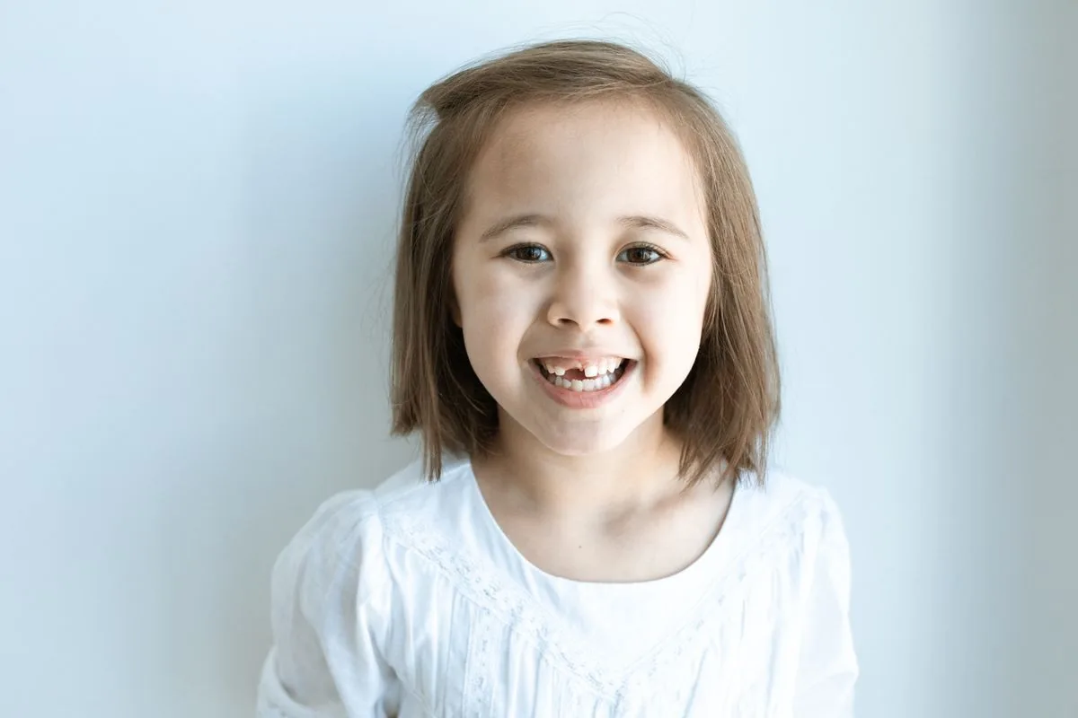 Niña sonriendo con el hueco de un diente de leche perdido, caso en que se valora un mantenedor de espacio