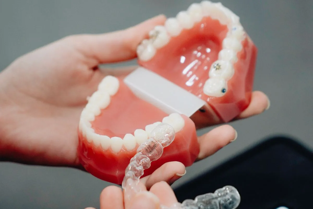 Modelo dental y férula transparente para explicar el retenedor fijo o removible después de la ortodoncia